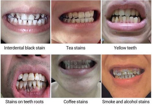 LXRMIMI Easy Teeth Whitening Essence