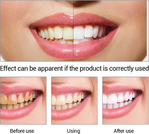 LXRMIMI Easy Teeth Whitening Essence